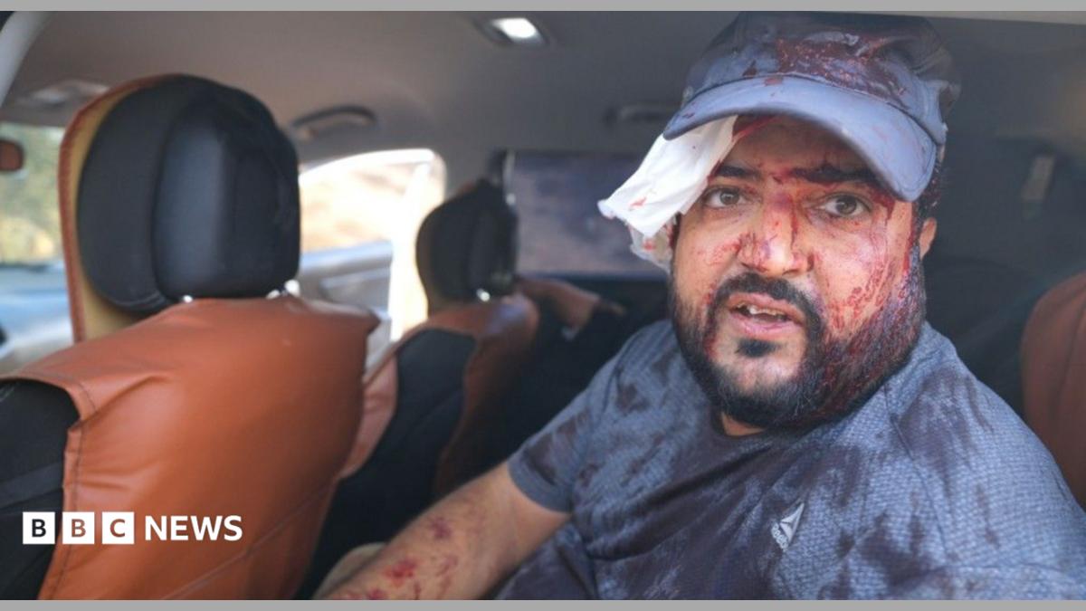 إصابات لفلسطينيين وصحفي أمريكي خلال حصاد الزيتون بالضفة الغربية