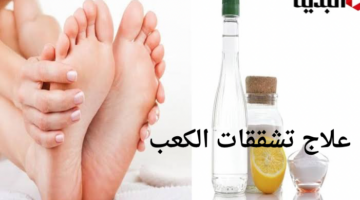 علاج تشققات الكعب