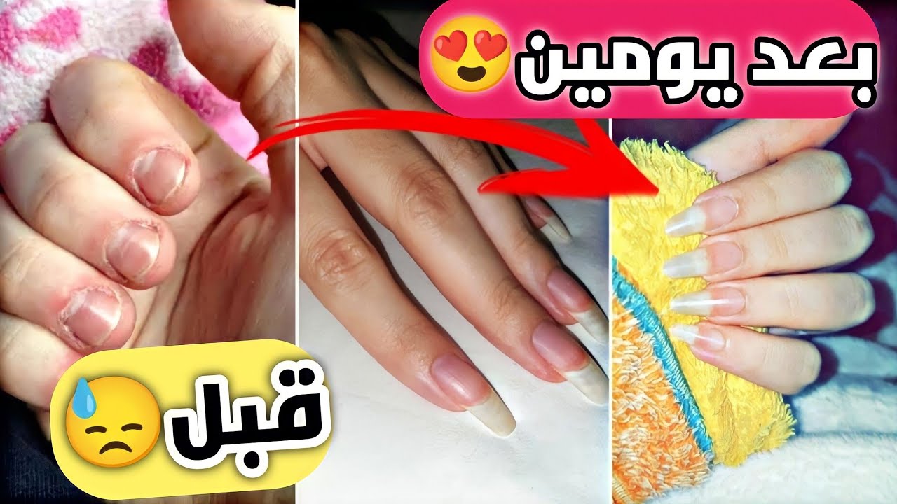 "للعرسان الجداد".. خلطات لتطويل الأظافر طبيعية بالمنزل وبخطوات سهلة وبسيطة مش هتجتاج منك وقت!