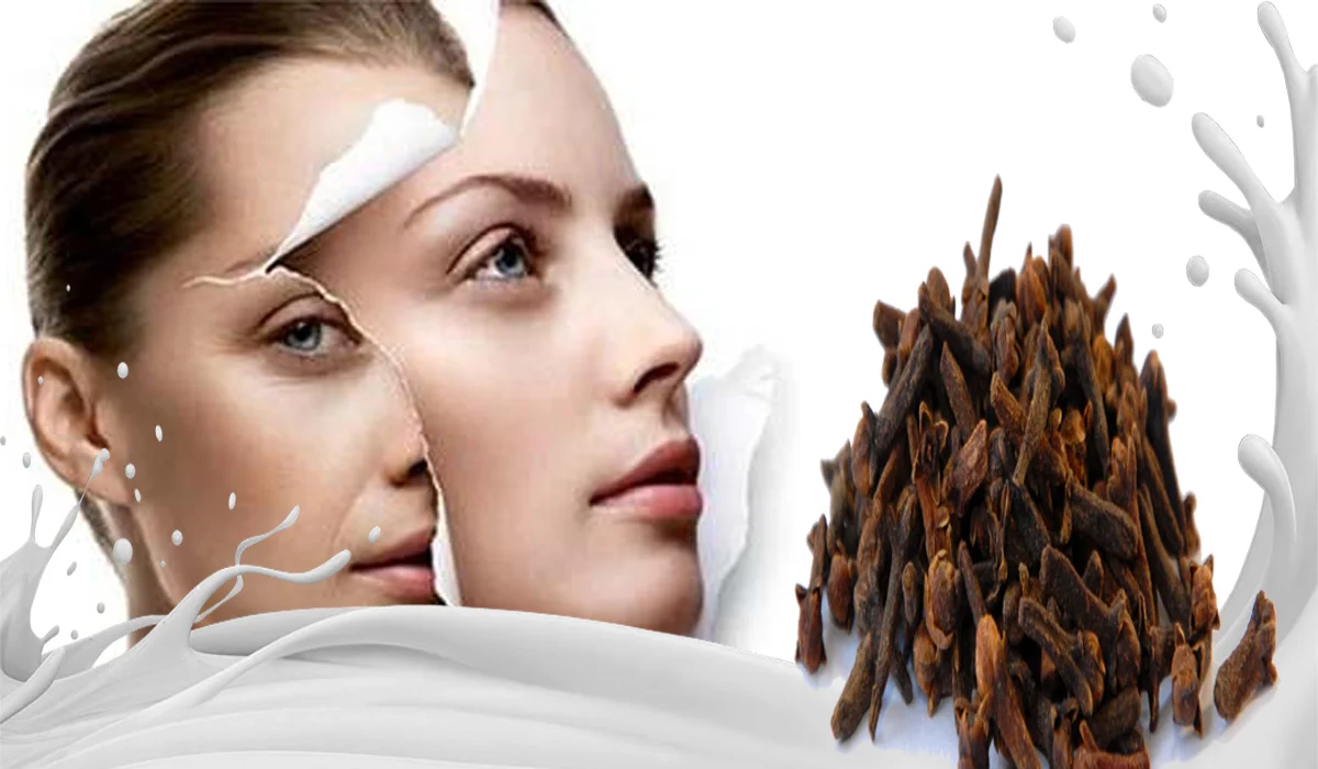 القرنفل القرنفل