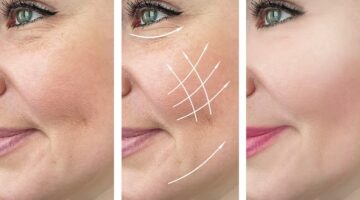 وصفة طبيعية للقضاء على التجاعيد