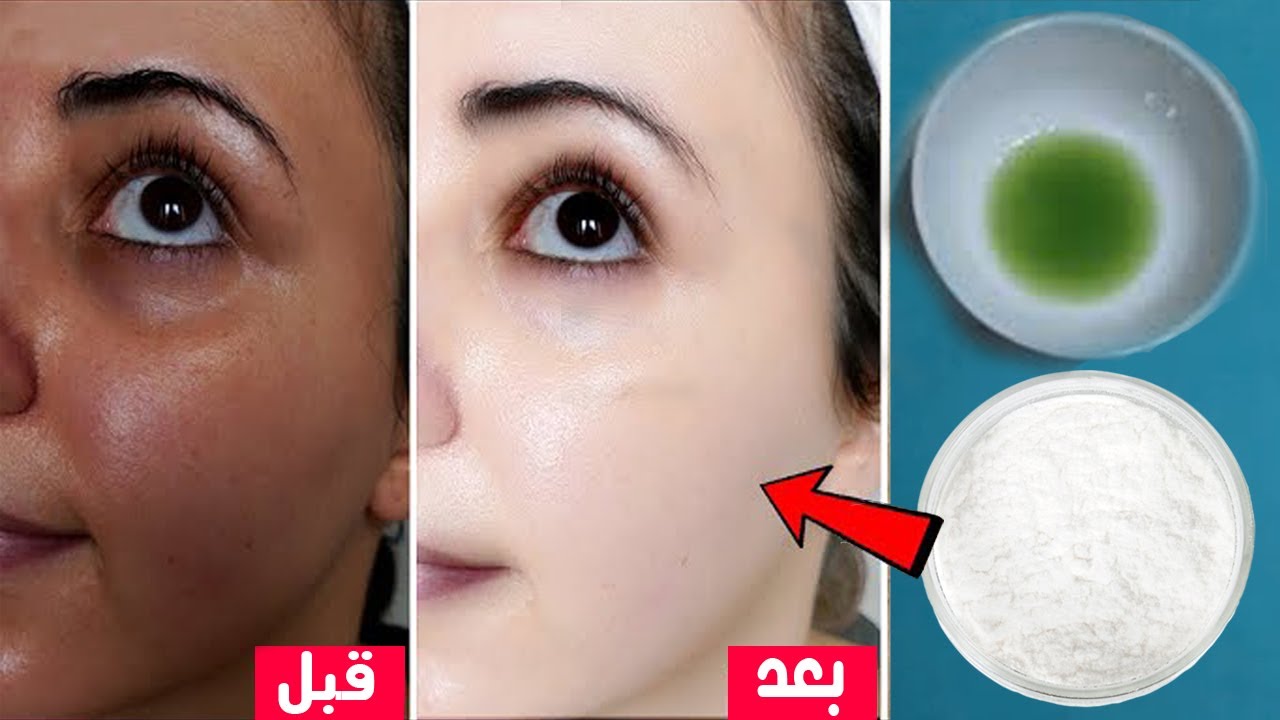 خليكي قد التحدي.. وصفة طبيعية لتبييض البشرة وإزالة الاسمرار هتحميكى من الشمس بمكونات بسيطة جدا وطبيعية