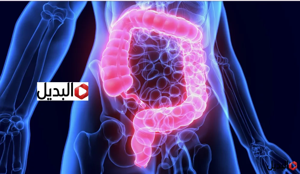 سرطان القولون والمستقيم يزداد بنسة 600%.. اعــرفالاعراض وطريقة الوقاية منه سرطان القولون والمستقيم يزداد بنسة 600%.. اعــرفالاعراض وطريقة الوقاية منه